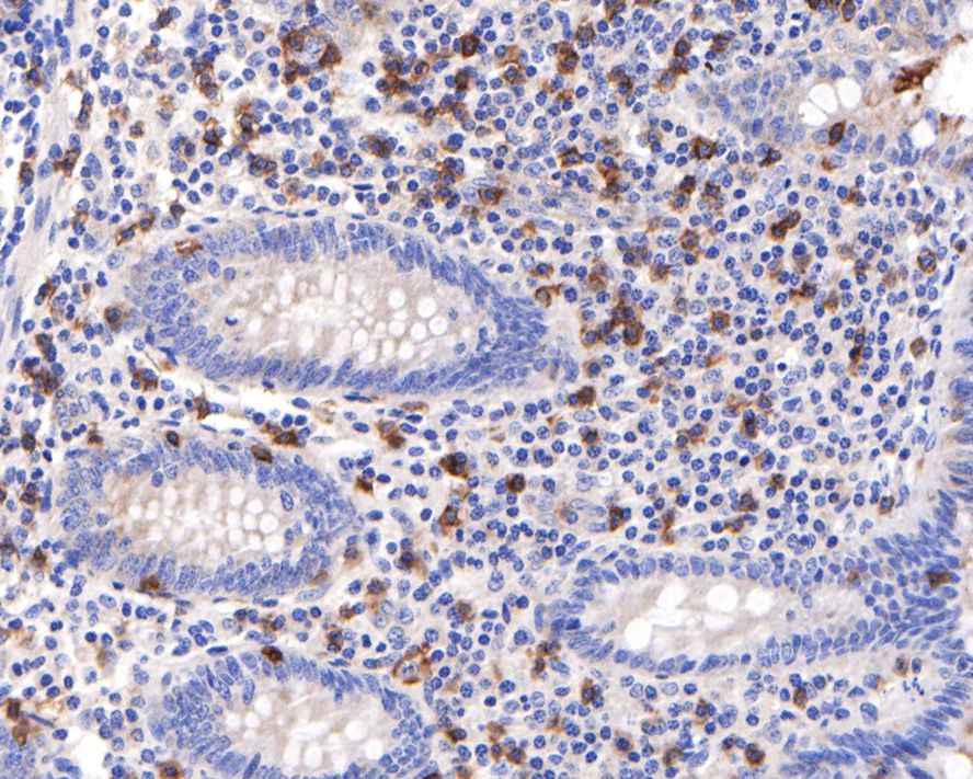 Immunohistochemical analysis of paraffin-embedded human appendix tissue with Rabbit anti-CD8 alpha antibody (ET1606-31) at 1/100 dilution.<br />
<br />
The section was pre-treated using heat mediated antigen retrieval with Tris-EDTA buffer (pH 9.0) for 20 minutes. The tissues were blocked in 1% BSA for 20 minutes at room temperature, washed with ddH2O and PBS, and then probed with the primary antibody (ET1606-31) at 1/100 dilution for 1 hour at room temperature. The detection was performed using an HRP conjugated compact polymer system. DAB was used as the chromogen. Tissues were counterstained with hematoxylin and mounted with DPX.