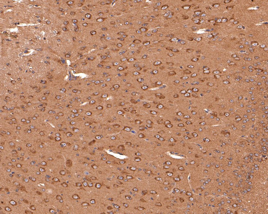 Immunohistochemical analysis of paraffin-embedded mouse brain tissue with Mouse anti-FAM38A/PIEZO1 antibody (M1005-2) at 1/200 dilution.<br />
<br />
The section was pre-treated using heat mediated antigen retrieval with Tris-EDTA buffer (pH 9.0) for 20 minutes. The tissues were blocked in 1% BSA for 20 minutes at room temperature, washed with ddH2O and PBS, and then probed with the primary antibody (M1005-2) at 1/200 dilution for 1 hour at room temperature. The detection was performed using an HRP conjugated compact polymer system. DAB was used as the chromogen. Tissues were counterstained with hematoxylin and mounted with DPX.