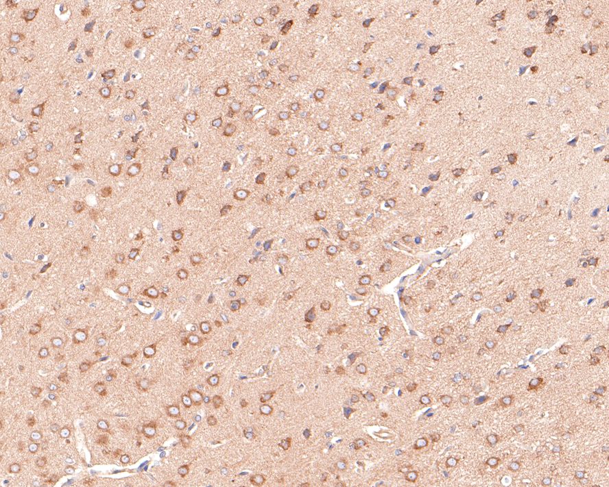 Immunohistochemical analysis of paraffin-embedded rat brain tissue with Mouse anti-FAM38A/PIEZO1 antibody (M1005-2) at 1/600 dilution.<br />
<br />
The section was pre-treated using heat mediated antigen retrieval with Tris-EDTA buffer (pH 9.0) for 20 minutes. The tissues were blocked in 1% BSA for 20 minutes at room temperature, washed with ddH2O and PBS, and then probed with the primary antibody (M1005-2) at 1/600 dilution for 1 hour at room temperature. The detection was performed using an HRP conjugated compact polymer system. DAB was used as the chromogen. Tissues were counterstained with hematoxylin and mounted with DPX.