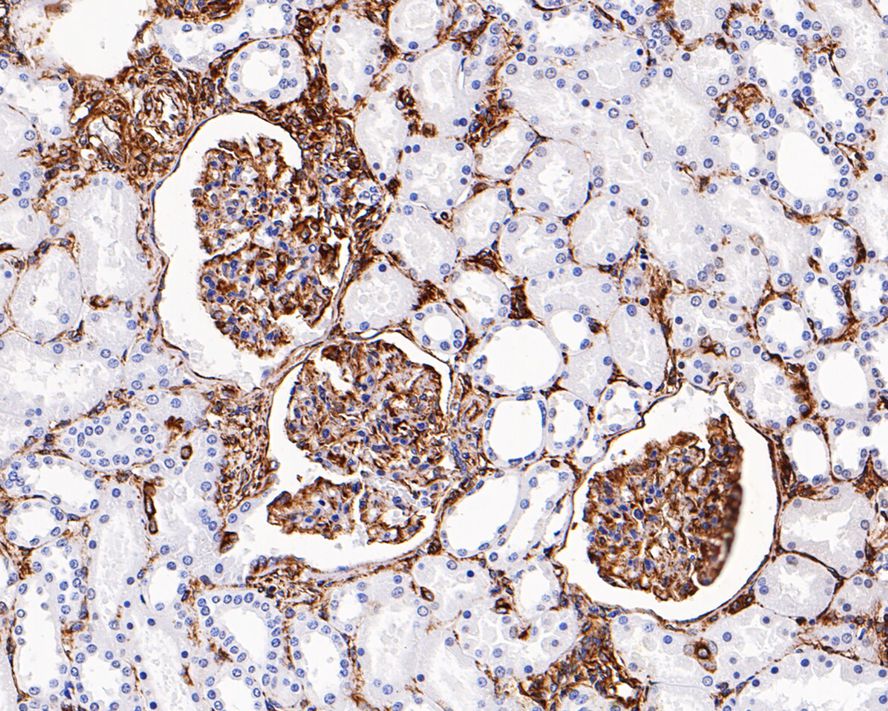 Immunohistochemical analysis of paraffin-embedded human appendix tissue with Mouse anti-Vimentin antibody (EM0401) at 1/500 dilution.<br />
<br />
The section was pre-treated using heat mediated antigen retrieval with Tris-EDTA buffer (pH 9.0) for 20 minutes. The tissues were blocked in 1% BSA for 20 minutes at room temperature, washed with ddH2O and PBS, and then probed with the primary antibody (EM0401) at 1/500 dilution for 1 hour at room temperature. The detection was performed using an HRP conjugated compact polymer system. DAB was used as the chromogen. Tissues were counterstained with hematoxylin and mounted with DPX.