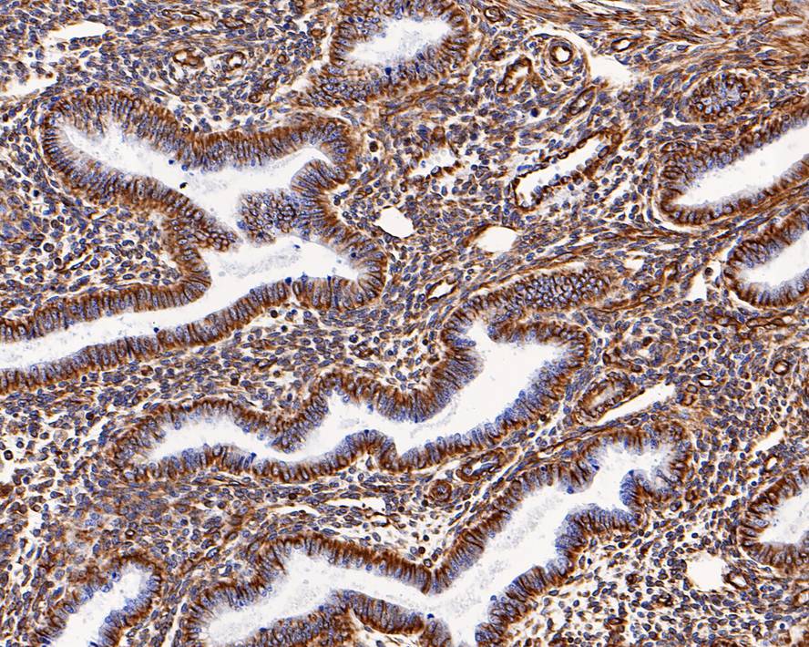 Immunohistochemical analysis of paraffin-embedded human kidney tissue with Mouse anti-Vimentin antibody (EM0401) at 1/2,000 dilution.<br />
<br />
The section was pre-treated using heat mediated antigen retrieval with Tris-EDTA buffer (pH 9.0) for 20 minutes. The tissues were blocked in 1% BSA for 20 minutes at room temperature, washed with ddH2O and PBS, and then probed with the primary antibody (EM0401) at 1/2,000 dilution for 1 hour at room temperature. The detection was performed using an HRP conjugated compact polymer system. DAB was used as the chromogen. Tissues were counterstained with hematoxylin and mounted with DPX.