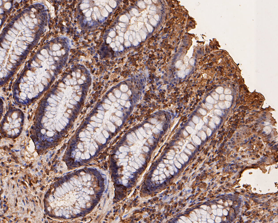 Immunohistochemical analysis of paraffin-embedded human colon tissue with Mouse anti-SCAI antibody (M1004-5) at 1/400 dilution.<br />
<br />
The section was pre-treated using heat mediated antigen retrieval with sodium citrate buffer (pH 6.0) for 2 minutes. The tissues were blocked in 1% BSA for 20 minutes at room temperature, washed with ddH2O and PBS, and then probed with the primary antibody (M1004-5) at 1/400 dilution for 1 hour at room temperature. The detection was performed using an HRP conjugated compact polymer system. DAB was used as the chromogen. Tissues were counterstained with hematoxylin and mounted with DPX.