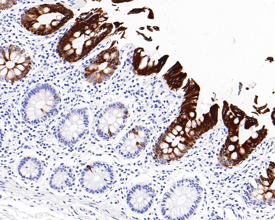 Immunohistochemical analysis of paraffin-embedded human colon tissue with Mouse anti-Cytokeratin 20 antibody (EM1901-97) at 1/1,000 dilution.<br />
<br />
The section was pre-treated using heat mediated antigen retrieval with Tris-EDTA buffer (pH 9.0) for 20 minutes. The tissues were blocked in 1% BSA for 20 minutes at room temperature, washed with ddH2O and PBS, and then probed with the primary antibody (EM1901-97) at 1/1,000 dilution for 1 hour at room temperature. The detection was performed using an HRP conjugated compact polymer system. DAB was used as the chromogen. Tissues were counterstained with hematoxylin and mounted with DPX.