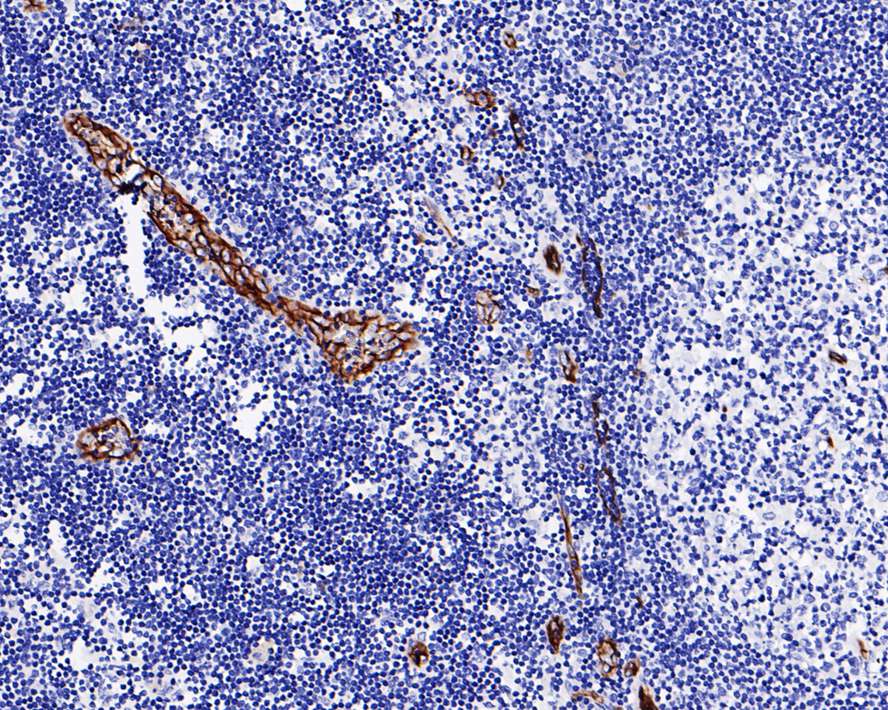 Immunohistochemical analysis of paraffin-embedded human lymph nodes tissue with Rabbit anti-Claudin 5 antibody (ET1703-58) at 1/200 dilution.<br />
<br />
The section was pre-treated using heat mediated antigen retrieval with Tris-EDTA buffer (pH 9.0) for 20 minutes. The tissues were blocked in 1% BSA for 20 minutes at room temperature, washed with ddH2O and PBS, and then probed with the primary antibody (ET1703-58) at 1/200 dilution for 1 hour at room temperature. The detection was performed using an HRP conjugated compact polymer system. DAB was used as the chromogen. Tissues were counterstained with hematoxylin and mounted with DPX.