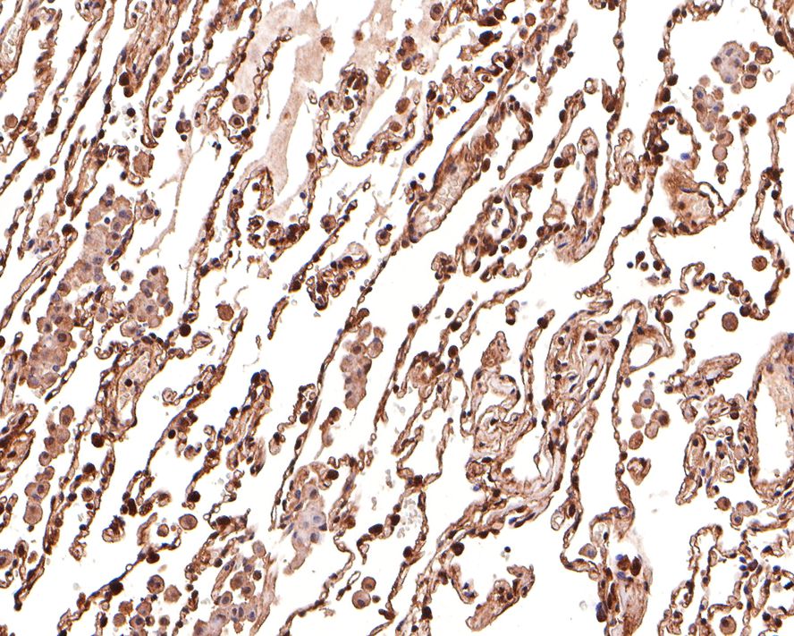 Immunohistochemical analysis of paraffin-embedded human lung tissue with Rabbit anti-GST3 antibody (ET7107-71) at 1/500 dilution.<br />
<br />
The section was pre-treated using heat mediated antigen retrieval with Tris-EDTA buffer (pH 9.0) for 20 minutes. The tissues were blocked in 1% BSA for 20 minutes at room temperature, washed with ddH2O and PBS, and then probed with the primary antibody (ET7107-71) at 1/500 dilution for 1 hour at room temperature. The detection was performed using an HRP conjugated compact polymer system. DAB was used as the chromogen. Tissues were counterstained with hematoxylin and mounted with DPX.
