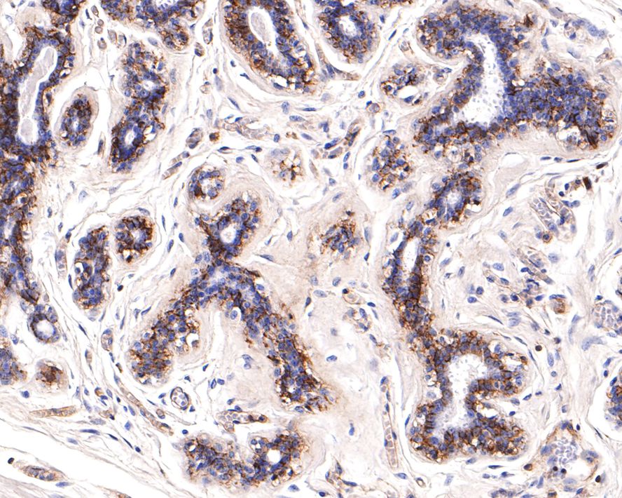 Immunohistochemical analysis of paraffin-embedded human breast tissue with Rabbit anti-CD46 antibody (ET7107-94) at 1/400 dilution.<br />
<br />
The section was pre-treated using heat mediated antigen retrieval with Tris-EDTA buffer (pH 9.0) for 20 minutes. The tissues were blocked in 1% BSA for 20 minutes at room temperature, washed with ddH2O and PBS, and then probed with the primary antibody (ET7107-94) at 1/400 dilution for 1 hour at room temperature. The detection was performed using an HRP conjugated compact polymer system. DAB was used as the chromogen. Tissues were counterstained with hematoxylin and mounted with DPX.