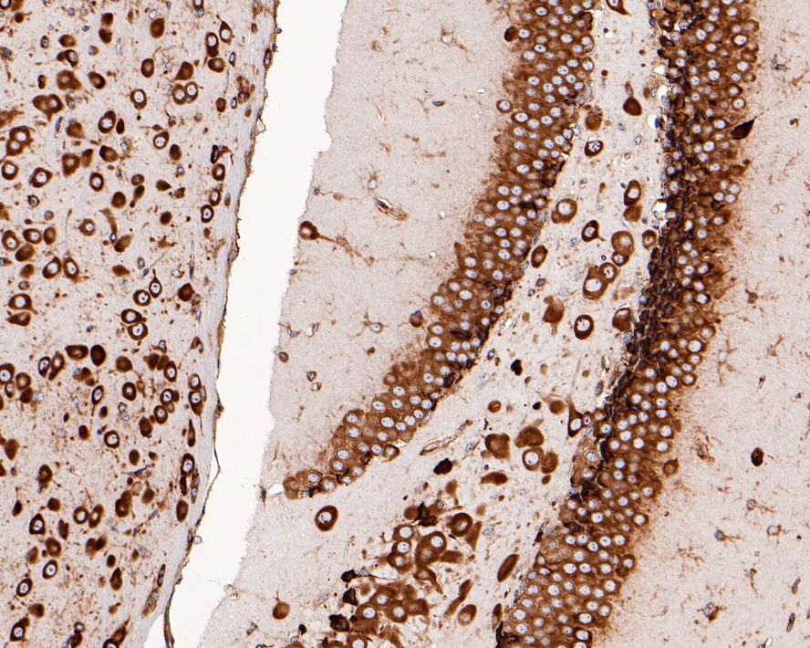 Immunohistochemical analysis of paraffin-embedded mouse hippocampus tissue with Rabbit anti-RPS20 antibody (ET1610-83) at 1/200 dilution.<br />
<br />
The section was pre-treated using heat mediated antigen retrieval with Tris-EDTA buffer (pH 9.0) for 20 minutes. The tissues were blocked in 1% BSA for 20 minutes at room temperature, washed with ddH2O and PBS, and then probed with the primary antibody (ET1610-83) at 1/200 dilution for 1 hour at room temperature. The detection was performed using an HRP conjugated compact polymer system. DAB was used as the chromogen. Tissues were counterstained with hematoxylin and mounted with DPX.