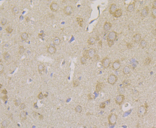 Immunohistochemical analysis of paraffin-embedded mouse brain tissue using anti-Carbonic anhydrase 2 antibody. The section was pre-treated using heat mediated antigen retrieval with Tris-EDTA buffer (pH 8.0-8.4) for 20 minutes.The tissues were blocked in 5% BSA for 30 minutes at room temperature, washed with ddH2O and PBS, and then probed with the antibody (EM1801-08) at 1/100 dilution, for 30 minutes at room temperature and detected using an HRP conjugated compact polymer system. DAB was used as the chrogen. Counter stained with hematoxylin and mounted with DPX.