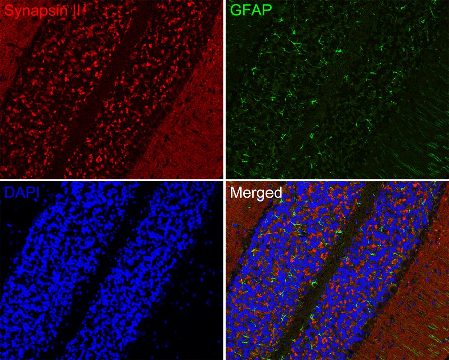 Immunofluorescence analysis of paraffin-embedded rat cerebellum tissue labeling Synapsin II (ET7109-88) and GFAP (EM140707).<br />
<br />
The section was pre-treated using heat mediated antigen retrieval with Tris-EDTA buffer (pH 9.0) for 20 minutes. The tissues were blocked in 10% negative goat serum for 1 hour at room temperature, washed with PBS. And then probed with the primary antibodies Synapsin II (ET7109-88, red) at 1/200 dilution and GFAP (EM140707, green) at 1/400 dilution overnight at 4 ℃, washed with PBS.<br />
<br />
iFluor™ 594 conjugate-Goat anti-Rabbit IgG (HA1122) and iFluor™ 488 conjugate-Goat anti-Mouse IgG (HA1125) were used as the secondary antibodies at 1/1,000 dilution. DAPI was used as nuclear counterstain.