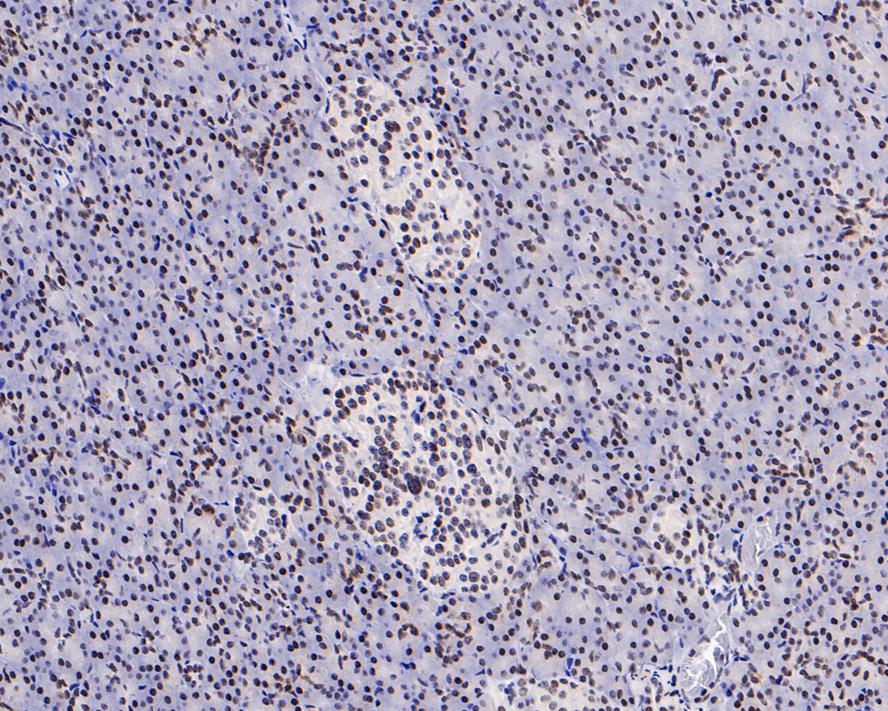 Immunohistochemical analysis of paraffin-embedded mouse pancreas tissue with Rabbit anti-HDAC1 antibody (ET1605-35) at 1/200 dilution.<br />
<br />
The section was pre-treated using heat mediated antigen retrieval with sodium citrate buffer (pH 6.0) for 2 minutes. The tissues were blocked in 1% BSA for 20 minutes at room temperature, washed with ddH2O and PBS, and then probed with the primary antibody (ET1605-35) at 1/200 dilution for 1 hour at room temperature. The detection was performed using an HRP conjugated compact polymer system. DAB was used as the chromogen. Tissues were counterstained with hematoxylin and mounted with DPX.