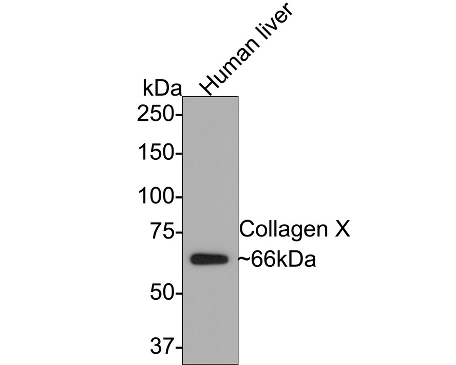 Western blot analysis of Collagen X on human liver tissue lysates with Rabbit anti-Collagen X antibody (ET1702-13) at 1/1,000 dilution.<br />
<br />
Lysates/proteins at 20 µg/Lane.<br />
<br />
Predicted band size: 66 kDa<br />
Observed band size: 66 kDa<br />
<br />
Exposure time: 2 minutes;<br />
<br />
8% SDS-PAGE gel.<br />
<br />
Proteins were transferred to a PVDF membrane and blocked with 5% NFDM/TBST for 1 hour at room temperature. The primary antibody (ET1702-13) at 1/1,000dilution was used in 5% NFDM/TBST at room temperature for 2 hours. Goat Anti-Rabbit IgG - HRP Secondary Antibody (HA1001) at 1:300,000 dilution was used for 1 hour at room temperature.