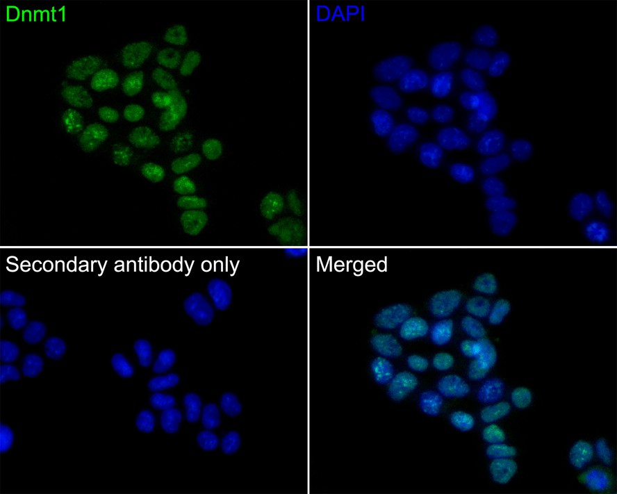Immunocytochemistry analysis of F9 cells labeling Dnmt1 with Rabbit anti-Dnmt1 antibody (ET1702-77) at 1/50 dilution.<br />
<br />
Cells were fixed in 4% paraformaldehyde for 10 minutes at 37 ℃, permeabilized with 0.05% Triton X-100 in PBS for 20 minutes, and then blocked with 2% negative goat serum for 30 minutes at room temperature. Cells were then incubated with Rabbit anti-Dnmt1 antibody (ET1702-77) at 1/50 dilution in 2% negative goat serum overnight at 4 ℃. Goat Anti-Rabbit IgG H&L (iFluor™ 488, HA1121) was used as the secondary antibody at 1/1,000 dilution. PBS instead of the primary antibody was used as the secondary antibody only control. Nuclear DNA was labelled in blue with DAPI.