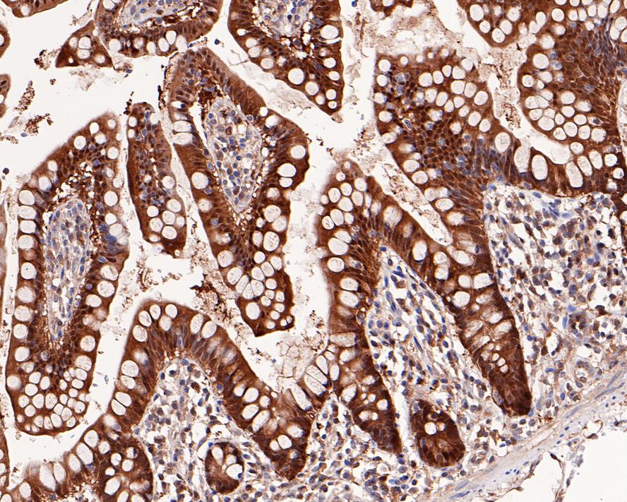 Immunohistochemical analysis of paraffin-embedded human small intestine tissue with Rabbit anti-Thioredoxin antibody (ET1703-03) at 1/2,000 dilution.<br />
<br />
The section was pre-treated using heat mediated antigen retrieval with sodium citrate buffer (pH 6.0) for 2 minutes. The tissues were blocked in 1% BSA for 20 minutes at room temperature, washed with ddH2O and PBS, and then probed with the primary antibody (ET1703-03) at 1/2,000 dilution for 1 hour at room temperature. The detection was performed using an HRP conjugated compact polymer system. DAB was used as the chromogen. Tissues were counterstained with hematoxylin and mounted with DPX.