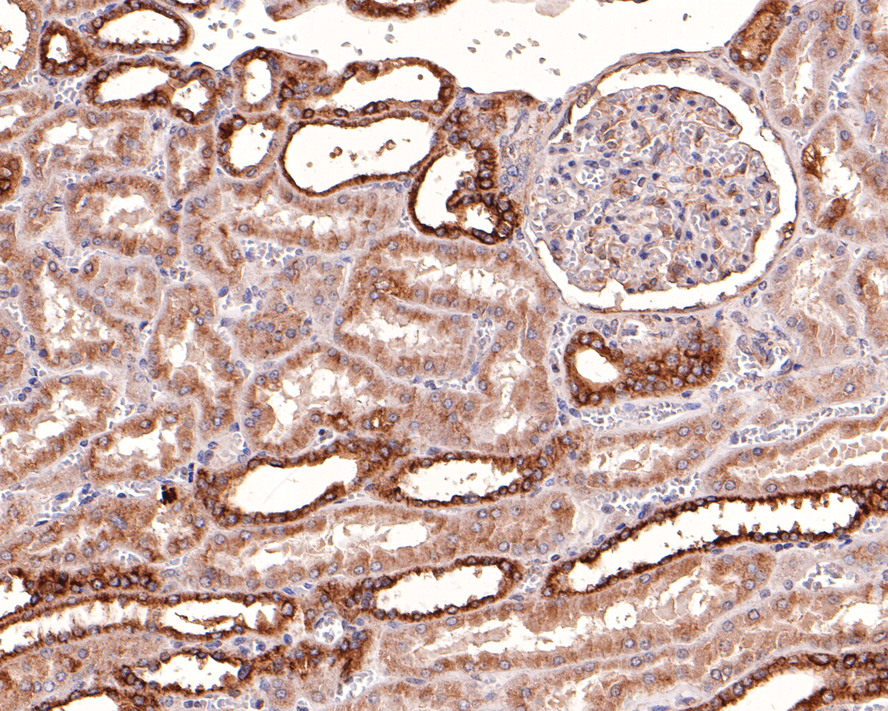 Immunohistochemical analysis of paraffin-embedded human uterus tissue with Mouse anti-Alpha-tubulin antibody (M1501-1) at 1/600 dilution.<br />
<br />
The section was pre-treated using heat mediated antigen retrieval with Tris-EDTA buffer (pH 9.0) for 20 minutes. The tissues were blocked in 1% BSA for 20 minutes at room temperature, washed with ddH2O and PBS, and then probed with the primary antibody (M1501-1) at 1/600 dilution for 1 hour at room temperature. The detection was performed using an HRP conjugated compact polymer system. DAB was used as the chromogen. Tissues were counterstained with hematoxylin and mounted with DPX.