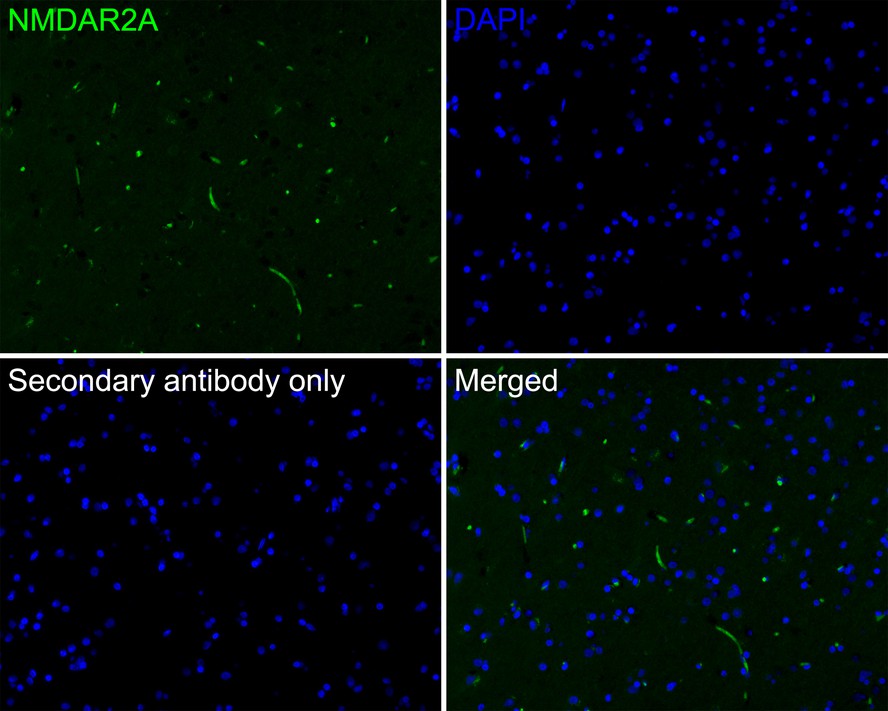 Immunofluorescence analysis of paraffin-embedded human brain tissue labeling NMDAR2A with Rabbit anti-NMDAR2A antibody (ET1704-80) at 1/200 dilution.<br />
<br />
The section was pre-treated using heat mediated antigen retrieval with Tris-EDTA buffer (pH 9.0) for 20 minutes. The tissues were blocked in 10% negative goat serum for 1 hour at room temperature, washed with PBS, and then probed with the primary antibody (ET1704-80, green) at 1/200 dilution overnight at 4 ℃, washed with PBS.<br />
<br />
Goat Anti-Rabbit IgG H&L (iFluor™ 488, HA1121) was used as the secondary antibody at 1/1,000 dilution. Nuclei were counterstained with DAPI (blue).