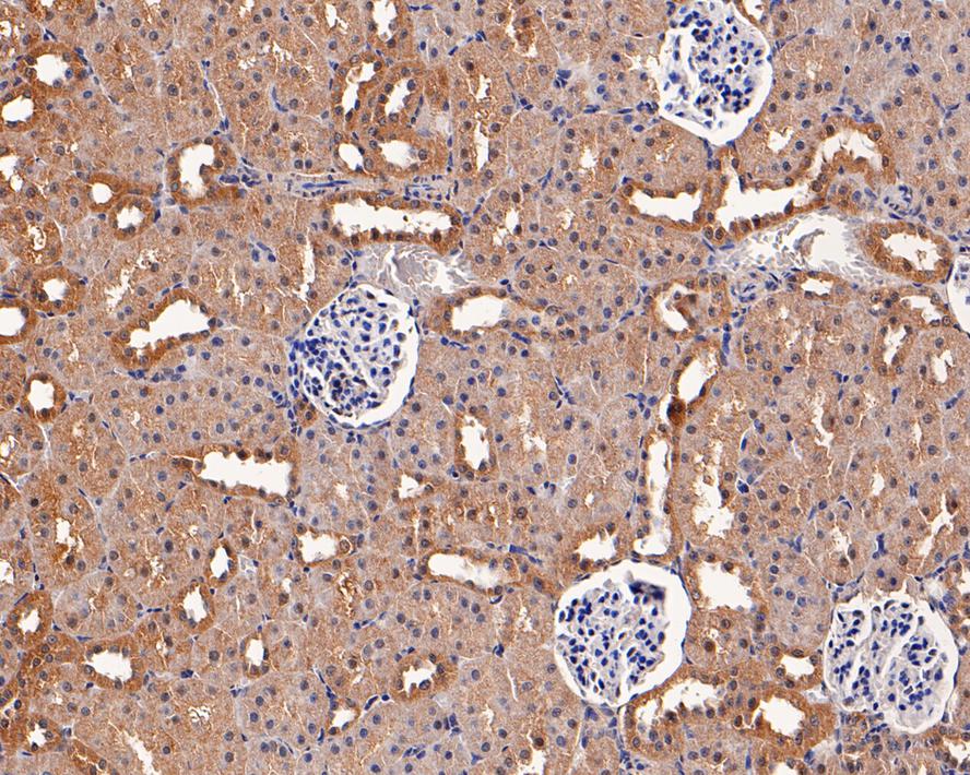 Immunohistochemical analysis of paraffin-embedded rat kidney tissue with Mouse anti-PRDX2 antibody (EM1701-72) at 1/200 dilution.<br />
<br />
The section was pre-treated using heat mediated antigen retrieval with Tris-EDTA buffer (pH 9.0) for 20 minutes. The tissues were blocked in 1% BSA for 20 minutes at room temperature, washed with ddH2O and PBS, and then probed with the primary antibody (EM1701-72) at 1/200 dilution for 1 hour at room temperature. The detection was performed using an HRP conjugated compact polymer system. DAB was used as the chromogen. Tissues were counterstained with hematoxylin and mounted with DPX.