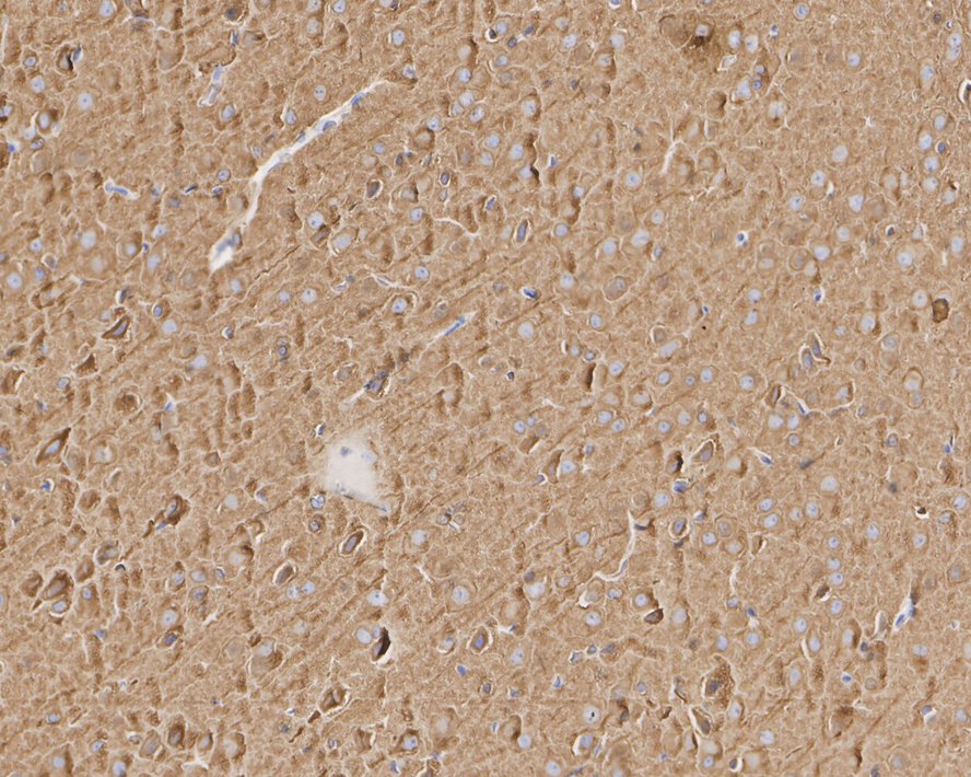 Immunohistochemical analysis of paraffin-embedded rat brain tissue with Mouse anti-Beta III Tubulin antibody (M0805-8) at 1/2,000 dilution.<br />
<br />
The section was pre-treated using heat mediated antigen retrieval with Tris-EDTA buffer (pH 9.0) for 20 minutes. The tissues were blocked in 1% BSA for 20 minutes at room temperature, washed with ddH2O and PBS, and then probed with the primary antibody (M0805-8) at 1/2,000 dilution for 1 hour at room temperature. The detection was performed using an HRP conjugated compact polymer system. DAB was used as the chromogen. Tissues were counterstained with hematoxylin and mounted with DPX.