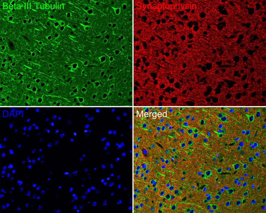 Immunofluorescence analysis of paraffin-embedded mouse brain tissue labeling Beta III Tubulin (M0805-8) and Synaptophysin (ET1606-56).<br />
<br />
The section was pre-treated using heat mediated antigen retrieval with Tris-EDTA buffer (pH 9.0) for 20 minutes. The tissues were blocked in 10% negative goat serum for 1 hour at room temperature, washed with PBS. And then probed with the primary antibodies Beta III Tubulin (M0805-8, green) at 1/200 dilution and Synaptophysin (ET1606-56, red) at 1/200 dilution overnight at 4 ℃, washed with PBS.<br />
<br />
Alexa Fluor® 488 conjugate-Goat anti-Mouse IgG and Alexa Fluor® 594 conjugate-Goat anti-Rabbit IgG were used as the secondary antibodies at 1/500 dilution. DAPI was used as nuclear counterstain.