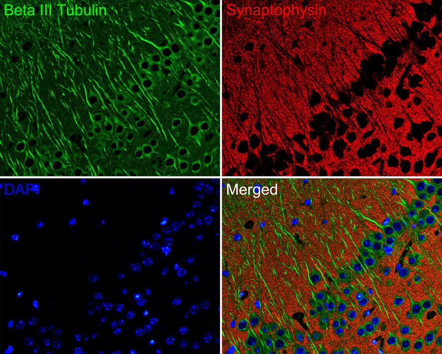 Immunofluorescence analysis of paraffin-embedded mouse hippocampus tissue labeling Beta III Tubulin (M0805-8) and Synaptophysin (ET1606-56).<br />
<br />
The section was pre-treated using heat mediated antigen retrieval with Tris-EDTA buffer (pH 9.0) for 20 minutes. The tissues were blocked in 10% negative goat serum for 1 hour at room temperature, washed with PBS. And then probed with the primary antibodies Beta III Tubulin (M0805-8, green) at 1/200 dilution and Synaptophysin (ET1606-56, red) at 1/200 dilution overnight at 4 ℃, washed with PBS.<br />
<br />
Alexa Fluor® 488 conjugate-Goat anti-Mouse IgG and Alexa Fluor® 594 conjugate-Goat anti-Rabbit IgG were used as the secondary antibodies at 1/500 dilution. DAPI was used as nuclear counterstain.
