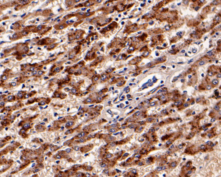 Immunohistochemical analysis of paraffin-embedded human liver tissue with Mouse anti-Catalase antibody (M1501-6) at 1/400 dilution.<br />
<br />
The section was pre-treated using heat mediated antigen retrieval with Tris-EDTA buffer (pH 9.0) for 20 minutes. The tissues were blocked in 1% BSA for 20 minutes at room temperature, washed with ddH2O and PBS, and then probed with the primary antibody (M1501-6) at 1/400 dilution for 1 hour at room temperature. The detection was performed using an HRP conjugated compact polymer system. DAB was used as the chromogen. Tissues were counterstained with hematoxylin and mounted with DPX.