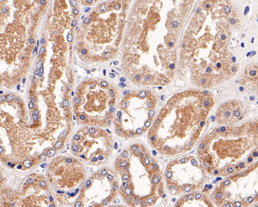 Immunohistochemical analysis of paraffin-embedded human kidney tissue with Mouse anti-Catalase antibody (M1501-6) at 1/100 dilution.<br />
<br />
The section was pre-treated using heat mediated antigen retrieval with Tris-EDTA buffer (pH 9.0) for 20 minutes. The tissues were blocked in 1% BSA for 20 minutes at room temperature, washed with ddH2O and PBS, and then probed with the primary antibody (M1501-6) at 1/100 dilution for 1 hour at room temperature. The detection was performed using an HRP conjugated compact polymer system. DAB was used as the chromogen. Tissues were counterstained with hematoxylin and mounted with DPX.