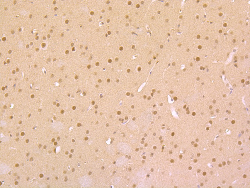 Immunohistochemical analysis of paraffin-embedded mouse brain tissue with Mouse anti-Cyclin E2 antibody (M0407-15) at 1/200 dilution.<br />
<br />
The section was pre-treated using heat mediated antigen retrieval with sodium citrate buffer (pH 6.0) for 2 minutes. The tissues were blocked in 1% BSA for 20 minutes at room temperature, washed with ddH2O and PBS, and then probed with the primary antibody (M0407-15) at 1/200 dilution for 1 hour at room temperature. The detection was performed using an HRP conjugated compact polymer system. DAB was used as the chromogen. Tissues were counterstained with hematoxylin and mounted with DPX.