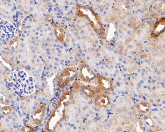 Immunohistochemical analysis of paraffin-embedded mouse kidney tissue with Rabbit anti-Cytokeratin 18 antibody (0407-1) at 1/400 dilution.<br />
<br />
The section was pre-treated using heat mediated antigen retrieval with Tris-EDTA buffer (pH 9.0) for 20 minutes. The tissues were blocked in 1% BSA for 20 minutes at room temperature, washed with ddH2O and PBS, and then probed with the primary antibody (0407-1) at 1/400 dilution for 1 hour at room temperature. The detection was performed using an HRP conjugated compact polymer system. DAB was used as the chromogen. Tissues were counterstained with hematoxylin and mounted with DPX.