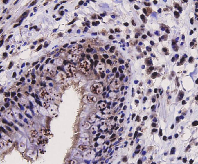 Immunohistochemical analysis of paraffin-embedded mouse testis tissue with Rabbit anti-SIRT1 antibody (ER130811) at 1/200 dilution.<br />
<br />
The section was pre-treated using heat mediated antigen retrieval with sodium citrate buffer (pH 6.0) for 2 minutes. The tissues were blocked in 1% BSA for 20 minutes at room temperature, washed with ddH2O and PBS, and then probed with the primary antibody (ER130811) at 1/200 dilution for 1 hour at room temperature. The detection was performed using an HRP conjugated compact polymer system. DAB was used as the chromogen. Tissues were counterstained with hematoxylin and mounted with DPX.