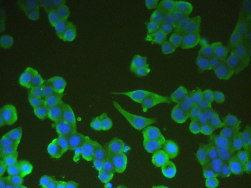 ICC staining UFO (green) in LOVO cells. The nuclear counter stain is DAPI (blue). Cells were fixed in paraformaldehyde, permeabilised with 0.25% Triton X100/PBS.