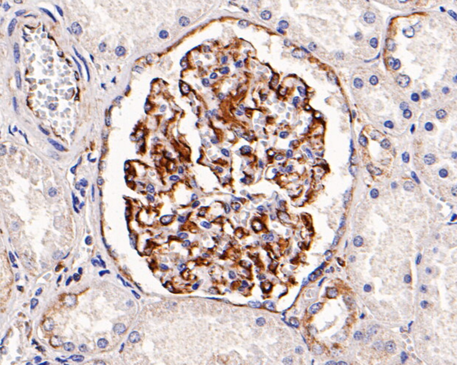 Immunohistochemical analysis of paraffin-embedded human kidney tissue with Mouse anti-Vimentin antibody (M1412-1) at 1/400 dilution.<br />
<br />
The section was pre-treated using heat mediated antigen retrieval with Tris-EDTA buffer (pH 9.0) for 20 minutes. The tissues were blocked in 1% BSA for 20 minutes at room temperature, washed with ddH2O and PBS, and then probed with the primary antibody (M1412-1) at 1/400 dilution for 1 hour at room temperature. The detection was performed using an HRP conjugated compact polymer system. DAB was used as the chromogen. Tissues were counterstained with hematoxylin and mounted with DPX.