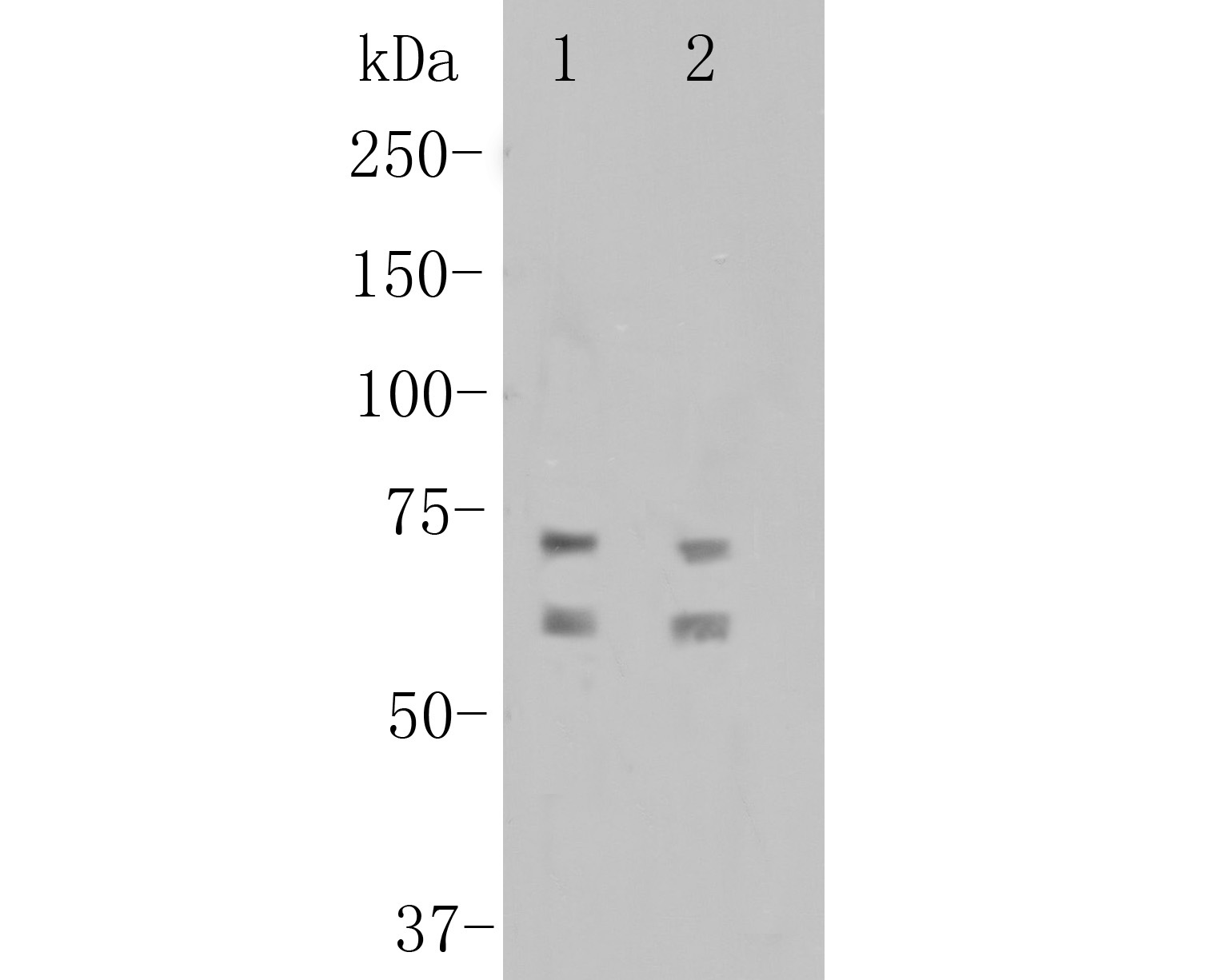 Western blot analysis of CNGA4 on different lysates. Proteins were transferred to a PVDF membrane and blocked with 5% BSA in PBS for 1 hour at room temperature. The primary antibody (ER1901-88, 1/500) was used in 5% BSA at room temperature for 2 hours. Goat Anti-Rabbit IgG - HRP Secondary Antibody (HA1001) at 1:5,000 dilution was used for 1 hour at room temperature.<br />
Positive control: <br />
Lane 1: A549 cell lysate<br />
Lane 2: A431 cell lysate