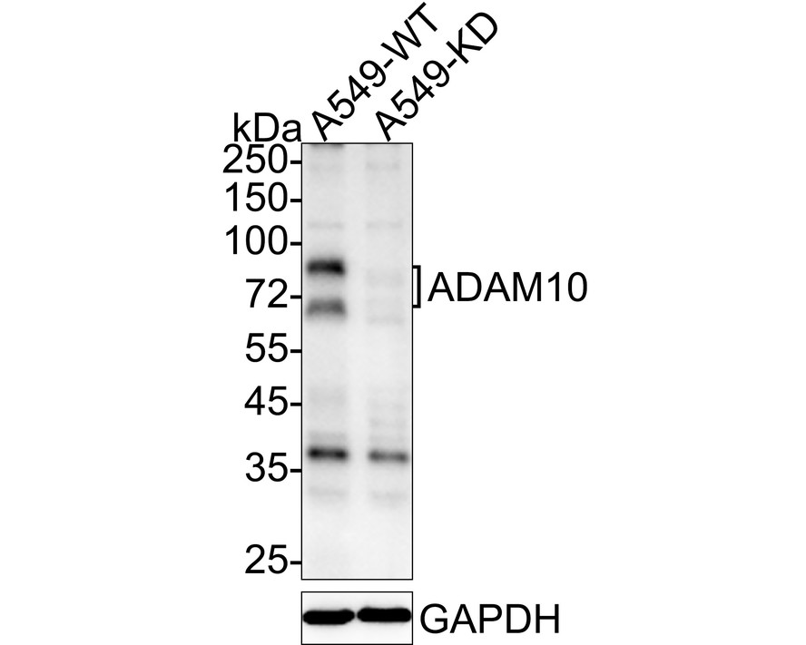 All lanes: Western blot analysis of ADAM10 with anti-ADAM10 antibody [SP08-04] (ET1703-60) at 1/1,000 dilution.<br />
<br />
Lane 1: Wild-type A549 whole cell lysate.<br />
Lane 2: ADAM10 knockout A549 whole cell lysate.<br />
<br />
ET1703-60 was shown to specifically react with ADAM10 in wild-type A549 cells. No band was observed when ADAM10 knockout sample was tested. Wild-type and ADAM10 knockout samples were subjected to SDS-PAGE. Proteins were transferred to a PVDF membrane and blocked with 5% NFDM in TBST for 1 hour at room temperature. The primary Anti-ADAM10 antibody (ET1703-60, 1/1,000) and Anti-Vinculin antibody (ET1705-94, 1/5,000) were used in 5% BSA at room temperature for 2 hours. Goat Anti-Rabbit IgG H&L (HRP) Secondary Antibody (HA1001) at 1:200,000 dilution was used for 1 hour at room temperature.<br />
<br />
Cell lysate was provided by Ubigene Biosciences (Ubigene Biosciences Co., Ltd., Guangzhou, China).
