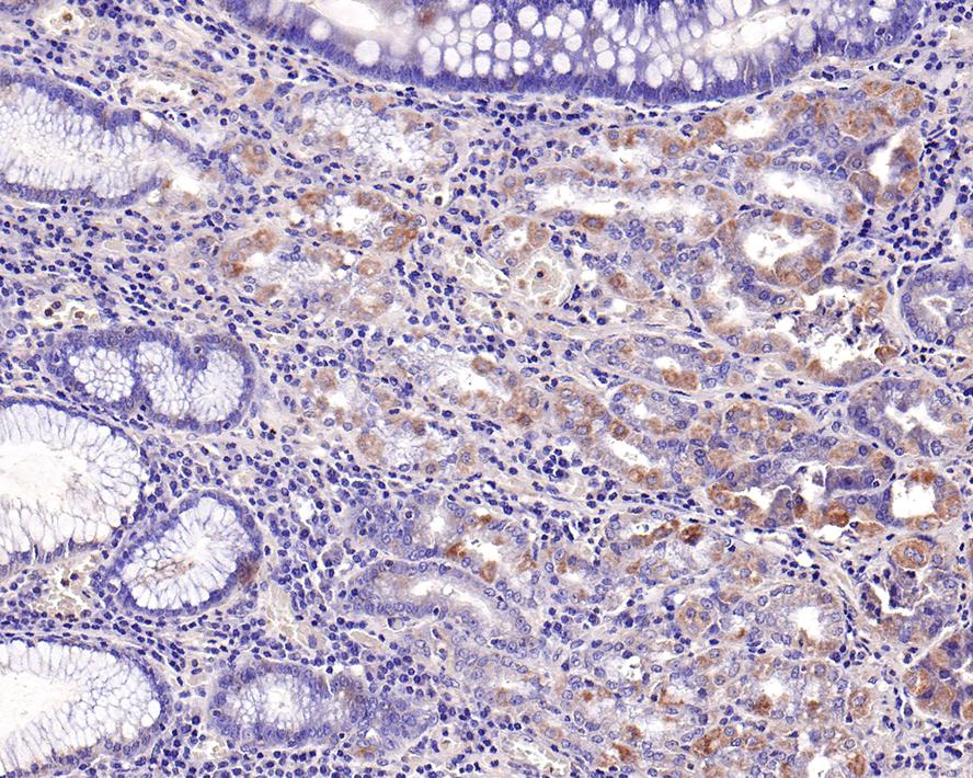 Immunohistochemical analysis of paraffin-embedded human stomach tissue with Rabbit anti-ADAM10 antibody (ET1703-60) at 1/100 dilution.<br />
<br />
The section was pre-treated using heat mediated antigen retrieval with Tris-EDTA buffer (pH 9.0) for 20 minutes. The tissues were blocked in 1% BSA for 20 minutes at room temperature, washed with ddH2O and PBS, and then probed with the primary antibody (ET1703-60) at 1/100 dilution for 1 hour at room temperature. The detection was performed using an HRP conjugated compact polymer system. DAB was used as the chromogen. Tissues were counterstained with hematoxylin and mounted with DPX.