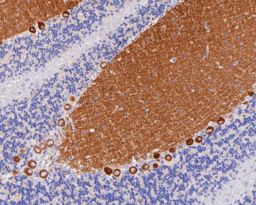 Immunohistochemical analysis of paraffin-embedded rat cerebellum tissue with Rabbit anti-mGluR1 antibody (ET1703-84) at 1/1,000 dilution.<br />
<br />
The section was pre-treated using heat mediated antigen retrieval with Tris-EDTA buffer (pH 9.0) for 20 minutes. The tissues were blocked in 1% BSA for 20 minutes at room temperature, washed with ddH2O and PBS, and then probed with the primary antibody (ET1703-84) at 1/1,000 dilution for 1 hour at room temperature. The detection was performed using an HRP conjugated compact polymer system. DAB was used as the chromogen. Tissues were counterstained with hematoxylin and mounted with DPX.