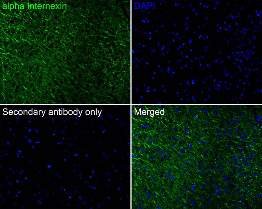 Immunofluorescence analysis of paraffin-embedded rat brain tissue labeling alpha Internexin with Rabbit anti-alpha Internexin antibody (ET1706-23) at 1/50 dilution.<br />
<br />
The section was pre-treated using heat mediated antigen retrieval with Tris-EDTA buffer (pH 9.0) for 20 minutes. The tissues were blocked in 10% negative goat serum for 1 hour at room temperature, washed with PBS, and then probed with the primary antibody (ET1706-23, green) at 1/50 dilution overnight at 4 ℃, washed with PBS.<br />
<br />
Goat Anti-Rabbit IgG H&L (iFluor™ 488, HA1121) was used as the secondary antibody at 1/1,000 dilution. Nuclei were counterstained with DAPI (blue).