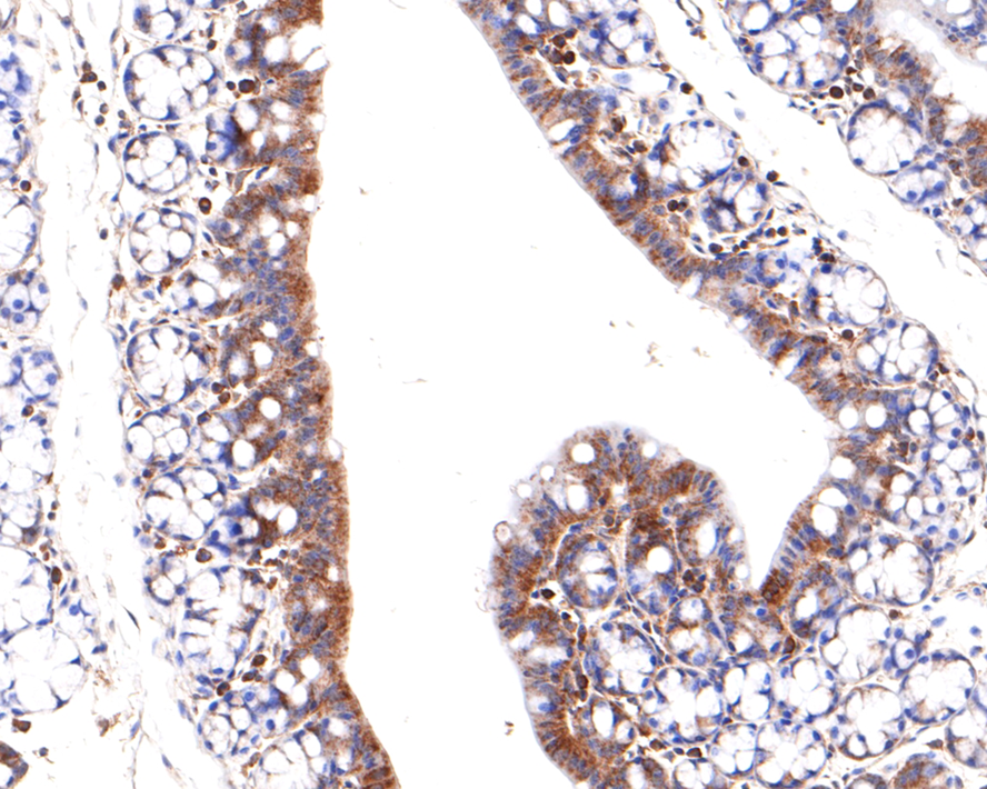 Immunohistochemical analysis of paraffin-embedded mouse colon tissue with Rabbit anti-NaV1.7 antibody (ER1706-57) at 1/600 dilution.<br />
<br />
The section was pre-treated using heat mediated antigen retrieval with Tris-EDTA buffer (pH 9.0) for 20 minutes. The tissues were blocked in 1% BSA for 20 minutes at room temperature, washed with ddH2O and PBS, and then probed with the primary antibody (ER1706-57) at 1/600 dilution for 1 hour at room temperature. The detection was performed using an HRP conjugated compact polymer system. DAB was used as the chromogen. Tissues were counterstained with hematoxylin and mounted with DPX.