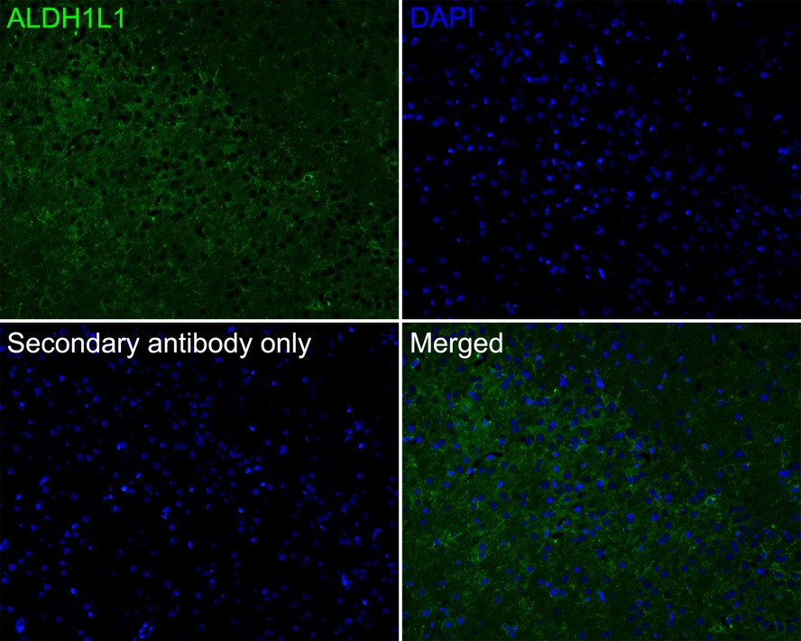 Immunofluorescence analysis of paraffin-embedded rat brain tissue labeling ALDH1L1 with Rabbit anti-ALDH1L1 antibody (ET7106-64) at 1/50 dilution.<br />
<br />
The section was pre-treated using heat mediated antigen retrieval with Tris-EDTA buffer (pH 9.0) for 20 minutes. The tissues were blocked in 10% negative goat serum for 1 hour at room temperature, washed with PBS, and then probed with the primary antibody (ET7106-64, green) at 1/50 dilution overnight at 4 ℃, washed with PBS.<br />
<br />
Goat Anti-Rabbit IgG H&L (iFluor™ 488, HA1121) was used as the secondary antibody at 1/1,000 dilution. Nuclei were counterstained with DAPI (blue).