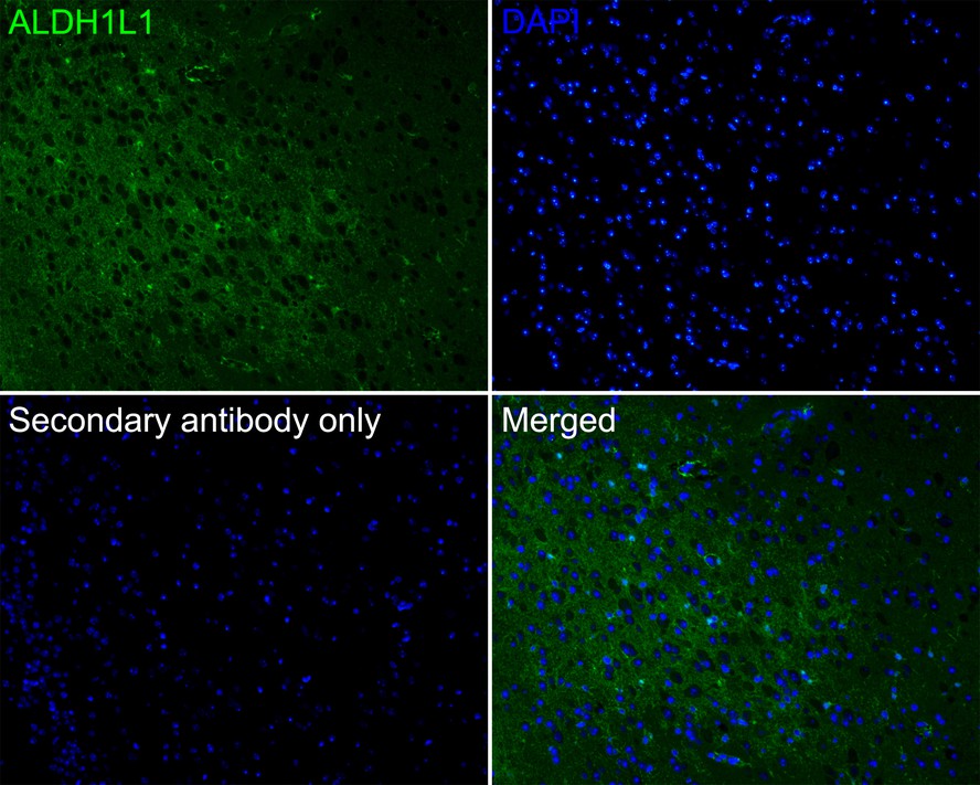 Immunofluorescence analysis of paraffin-embedded mouse brain tissue labeling ALDH1L1 with Rabbit anti-ALDH1L1 antibody (ET7106-64) at 1/200 dilution.<br />
<br />
The section was pre-treated using heat mediated antigen retrieval with Tris-EDTA buffer (pH 9.0) for 20 minutes. The tissues were blocked in 10% negative goat serum for 1 hour at room temperature, washed with PBS, and then probed with the primary antibody (ET7106-64, green) at 1/200 dilution overnight at 4 ℃, washed with PBS.<br />
<br />
Goat Anti-Rabbit IgG H&L (iFluor™ 488, HA1121) was used as the secondary antibody at 1/1,000 dilution. Nuclei were counterstained with DAPI (blue).