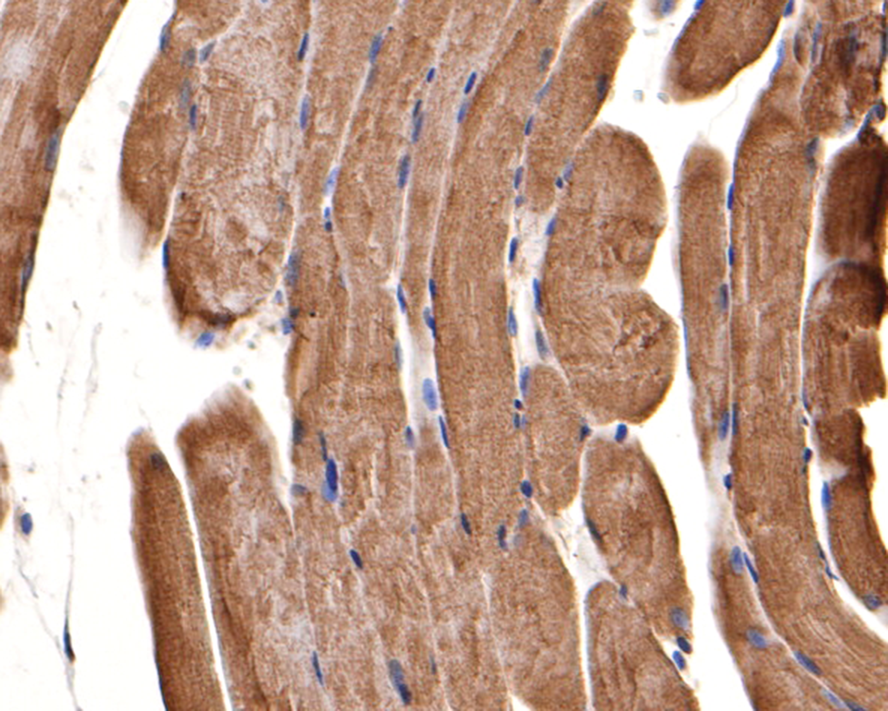 Immunohistochemical analysis of paraffin-embedded rat skeletal muscle tissue with Rabbit anti-CACNB1 antibody (ER1803-29) at 1/200 dilution.<br />
<br />
The section was pre-treated using heat mediated antigen retrieval with Tris-EDTA buffer (pH 9.0) for 20 minutes. The tissues were blocked in 1% BSA for 20 minutes at room temperature, washed with ddH2O and PBS, and then probed with the primary antibody (ER1803-29) at 1/200 dilution for 1 hour at room temperature. The detection was performed using an HRP conjugated compact polymer system. DAB was used as the chromogen. Tissues were counterstained with hematoxylin and mounted with DPX.