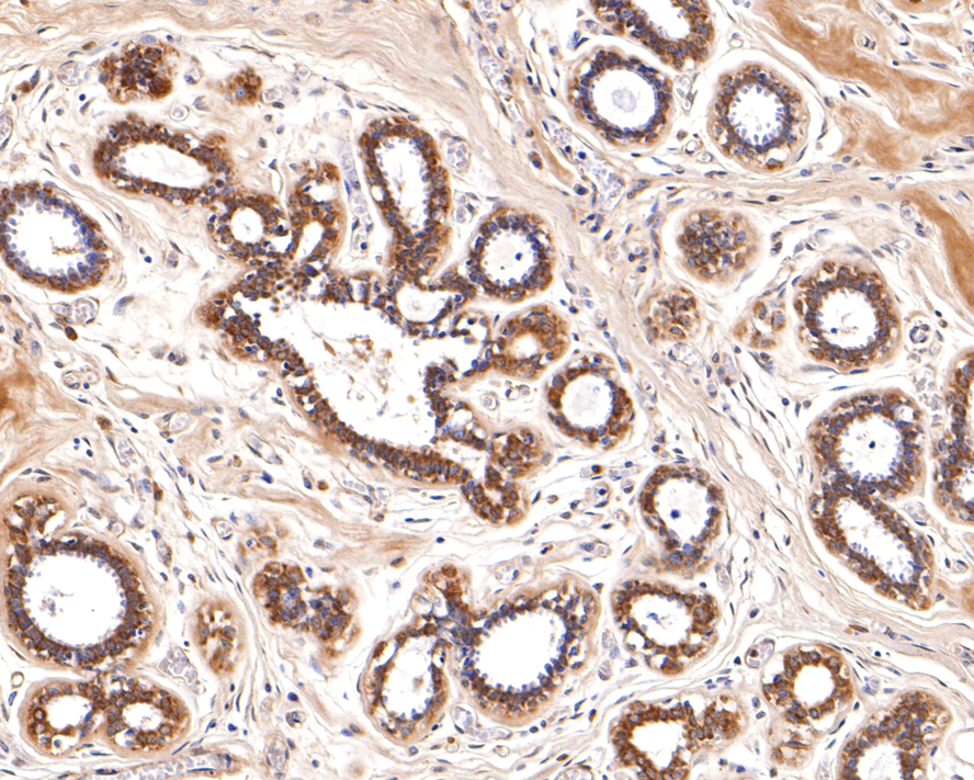 Immunohistochemical analysis of paraffin-embedded Human breast tissue with Rabbit anti-TRADD antibody (ER1901-79) at 1/200 dilution.<br />
<br />
The section was pre-treated using heat mediated antigen retrieval with Tris-EDTA buffer (pH 9.0) for 20 minutes. The tissues were blocked in 1% BSA for 20 minutes at room temperature, washed with ddH2O and PBS, and then probed with the primary antibody (ER1901-79) at 1/200 dilution for 1 hour at room temperature. The detection was performed using an HRP conjugated compact polymer system. DAB was used as the chromogen. Tissues were counterstained with hematoxylin and mounted with DPX.