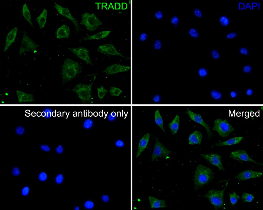 ICC staining of TRADD in SH-SY5Y cells (green). Formalin fixed cells were permeabilized with 0.1% Triton X-100 in TBS for 10 minutes at room temperature and blocked with 10% negative goat serum for 15 minutes at room temperature. Cells were probed with the primary antibody (ER1901-79, 1/200) for 1 hour at room temperature, washed with PBS. Alexa Fluor®488 conjugate-Goat anti-Rabbit IgG was used as the secondary antibody at 1/1,000 dilution. The nuclear counter stain is DAPI (blue).