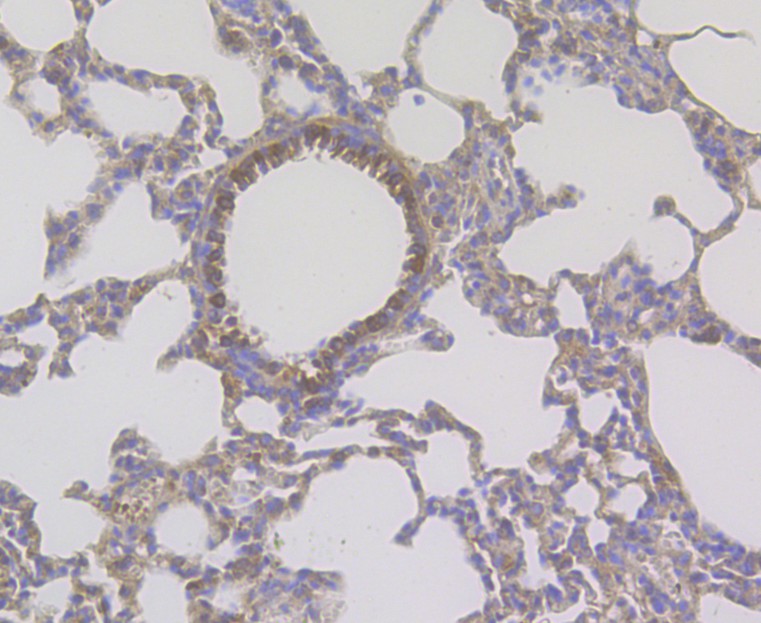Immunohistochemical analysis of paraffin-embedded rat lung tissue using anti-CD163 antibody. The section was pre-treated using heat mediated antigen retrieval with Tris-EDTA buffer (pH 8.0-8.4) for 20 minutes.The tissues were blocked in 5% BSA for 30 minutes at room temperature, washed with ddH2O and PBS, and then probed with the antibody (ER1804-03) at 1/50 dilution, for 30 minutes at room temperature and detected using an HRP conjugated compact polymer system. DAB was used as the chromogen. Counter stained with hematoxylin and mounted with DPX.