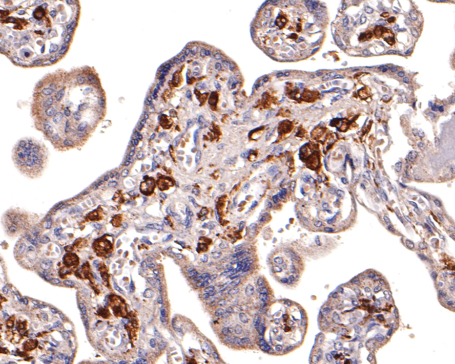 Immunohistochemical analysis of paraffin-embedded human placenta tissue using anti-CD163 antibody. The section was pre-treated using heat mediated antigen retrieval with Tris-EDTA buffer (pH 8.0-8.4) for 20 minutes.The tissues were blocked in 5% BSA for 30 minutes at room temperature, washed with ddH2O and PBS, and then probed with the antibody (ER1804-03) at 1/200 dilution, for 30 minutes at room temperature and detected using an HRP conjugated compact polymer system. DAB was used as the chromogen. Counter stained with hematoxylin and mounted with DPX.