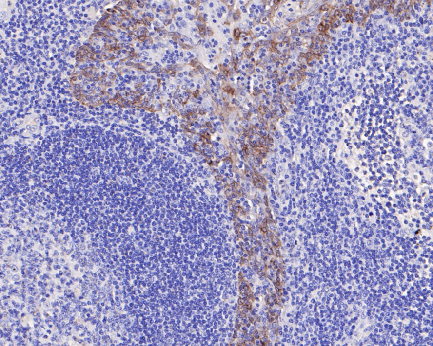 "Immunohistochemical analysis of paraffin-embedded human tonsil tissue with Rabbit anti-Cytokeratin 14 antibody (ER1901-08) at 1/200 dilution.<br />
<br />
The section was pre-treated using heat mediated antigen retrieval with Tris-EDTA buffer (pH 9.0) for 20 minutes. The tissues were blocked in 1% BSA for 20 minutes at room temperature, washed with ddH2O and PBS, and then probed with the primary antibody (ER1901-08) at 1/200 dilution for 1 hour at room temperature. The detection was performed using an HRP conjugated compact polymer system. DAB was used as the chromogen. Tissues were counterstained with hematoxylin and mounted with DPX.