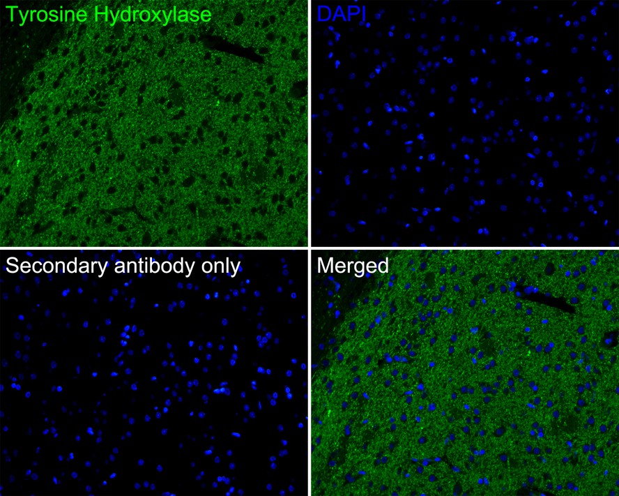 Immunofluorescence analysis of paraffin-embedded mouse brain tissue labeling Tyrosine Hydroxylase with Rabbit anti-Tyrosine Hydroxylase antibody (ET1611-12) at 1/200 dilution.<br />
<br />
The section was pre-treated using heat mediated antigen retrieval with Tris-EDTA buffer (pH 9.0) for 20 minutes. The tissues were blocked in 10% negative goat serum for 1 hour at room temperature, washed with PBS, and then probed with the primary antibody (ET1611-12, green) at 1/200 dilution overnight at 4 ℃, washed with PBS.<br />
<br />
Goat Anti-Rabbit IgG H&L (iFluor™ 488, HA1121) was used as the secondary antibody at 1/1,000 dilution. Nuclei were counterstained with DAPI (blue).