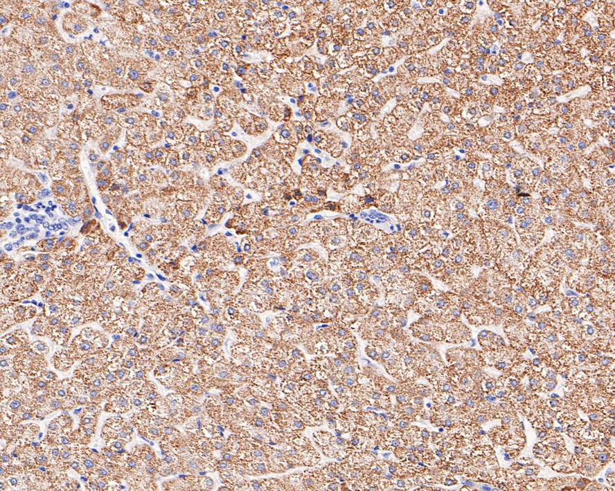 Immunohistochemical analysis of paraffin-embedded human liver tissue with Rabbit anti-TIMM50 (Tim50) antibody (ET7110-24) at 1/1,000 dilution.<br />
<br />
The section was pre-treated using heat mediated antigen retrieval with sodium citrate buffer (pH 6.0) for 2 minutes. The tissues were blocked in 1% BSA for 20 minutes at room temperature, washed with ddH2O and PBS, and then probed with the primary antibody (ET7110-24) at 1/1,000 dilution for 1 hour at room temperature. The detection was performed using an HRP conjugated compact polymer system. DAB was used as the chromogen. Tissues were counterstained with hematoxylin and mounted with DPX.
