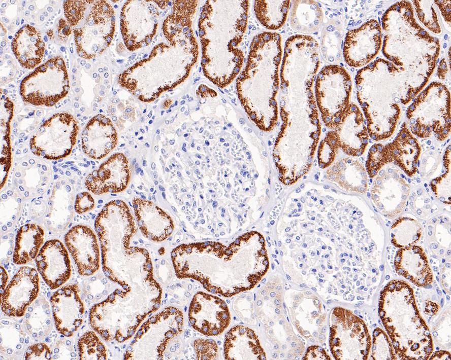 Immunohistochemical analysis of paraffin-embedded human kidney tissue with Rabbit anti-TIMM50 (Tim50) antibody (ET7110-24) at 1/1,000 dilution.<br />
<br />
The section was pre-treated using heat mediated antigen retrieval with sodium citrate buffer (pH 6.0) for 2 minutes. The tissues were blocked in 1% BSA for 20 minutes at room temperature, washed with ddH2O and PBS, and then probed with the primary antibody (ET7110-24) at 1/1,000 dilution for 1 hour at room temperature. The detection was performed using an HRP conjugated compact polymer system. DAB was used as the chromogen. Tissues were counterstained with hematoxylin and mounted with DPX.