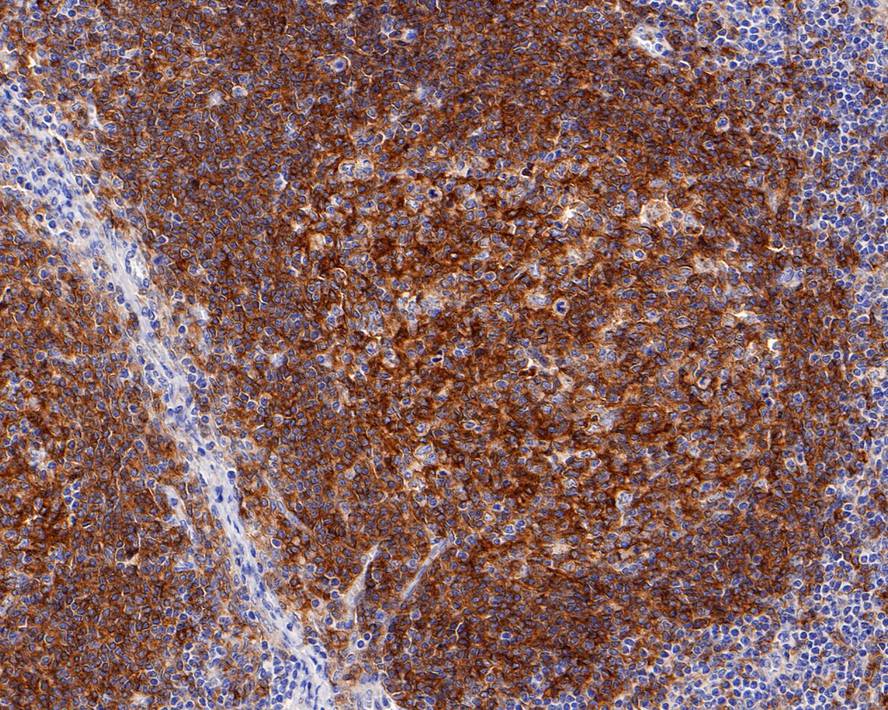 Immunohistochemical analysis of paraffin-embedded human lymph nodes tissue with Mouse anti-CD40 antibody (EM1901-41) at 1/1,000 dilution.<br />
<br />
The section was pre-treated using heat mediated antigen retrieval with Tris-EDTA buffer (pH 9.0) for 20 minutes. The tissues were blocked in 1% BSA for 20 minutes at room temperature, washed with ddH2O and PBS, and then probed with the primary antibody (EM1901-41) at 1/1,000 dilution for 1 hour at room temperature. The detection was performed using an HRP conjugated compact polymer system. DAB was used as the chromogen. Tissues were counterstained with hematoxylin and mounted with DPX.