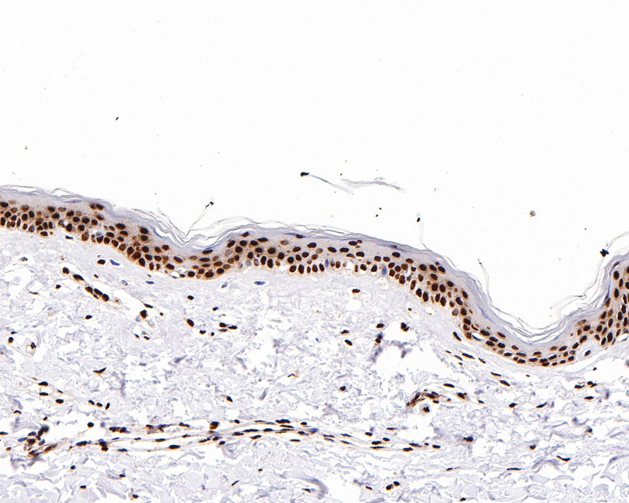 Immunohistochemical analysis of paraffin-embedded human skin tissue with Rabbit anti-Histone H3 (mono+di+tri methyl K79) antibody (ET1602-41) at 1/1,000 dilution.<br />
<br />
The section was pre-treated using heat mediated antigen retrieval with sodium citrate buffer (pH 6.0) for 2 minutes. The tissues were blocked in 1% BSA for 20 minutes at room temperature, washed with ddH2O and PBS, and then probed with the primary antibody (ET1602-41) at 1/1,000 dilution for 1 hour at room temperature. The detection was performed using an HRP conjugated compact polymer system. DAB was used as the chromogen. Tissues were counterstained with hematoxylin and mounted with DPX.