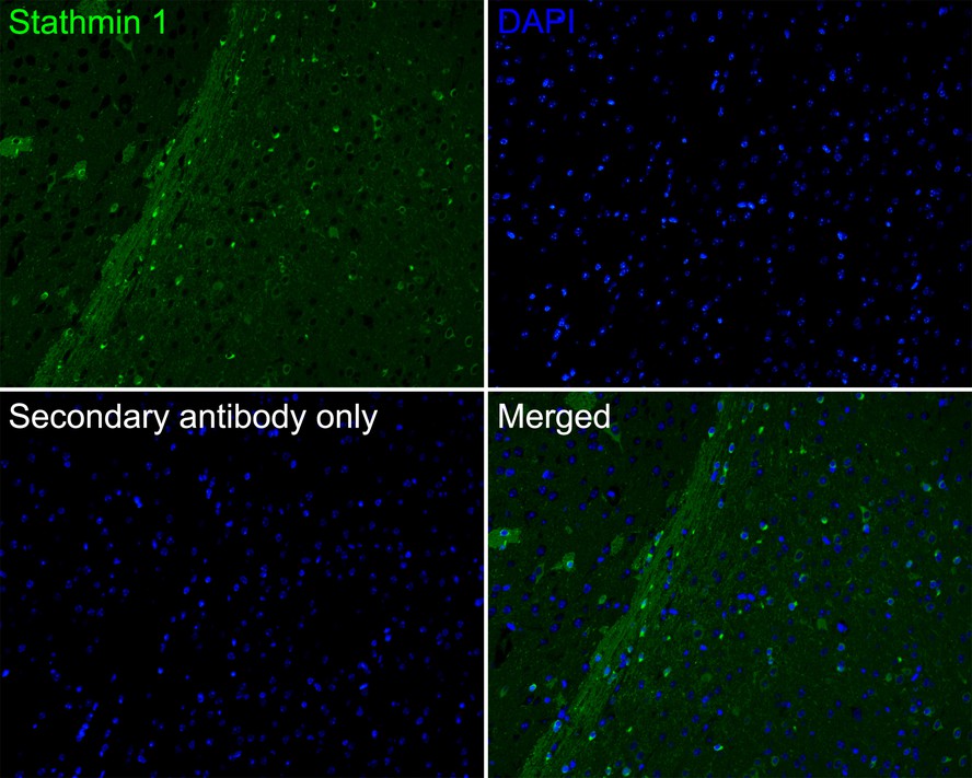 Immunofluorescence analysis of paraffin-embedded mouse brain tissue labeling Stathmin 1 with Rabbit anti-Stathmin 1 antibody (ET1609-20) at 1/50 dilution.<br />
<br />
The section was pre-treated using heat mediated antigen retrieval with Tris-EDTA buffer (pH 9.0) for 20 minutes. The tissues were blocked in 10% negative goat serum for 1 hour at room temperature, washed with PBS, and then probed with the primary antibody (ET1609-20, green) at 1/50 dilution overnight at 4 ℃, washed with PBS.<br />
<br />
Goat Anti-Rabbit IgG H&L (iFluor™ 488, HA1121) was used as the secondary antibody at 1/1,000 dilution. Nuclei were counterstained with DAPI (blue).